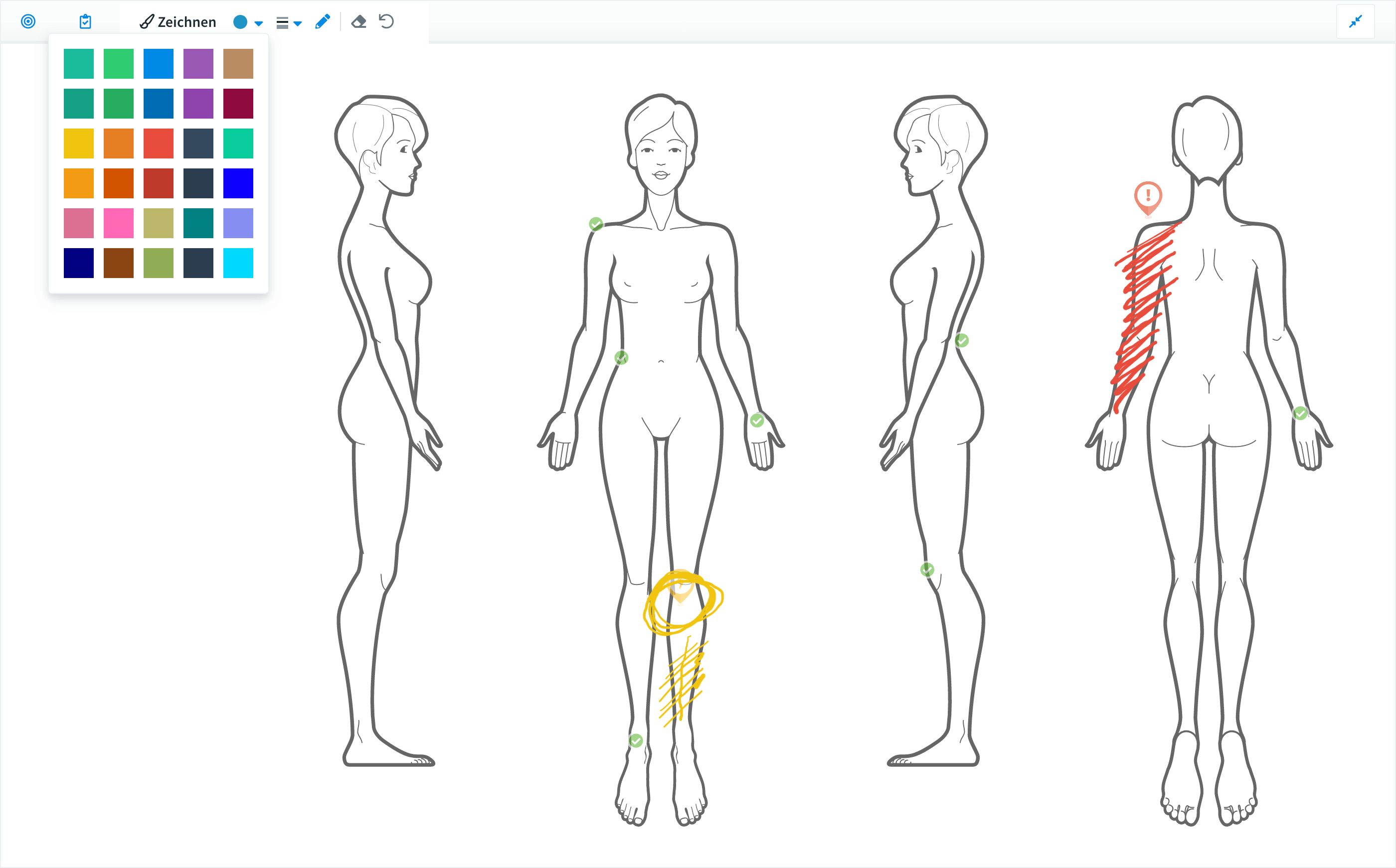 Interaktiver Bodychart zur visuellen Dokumentation