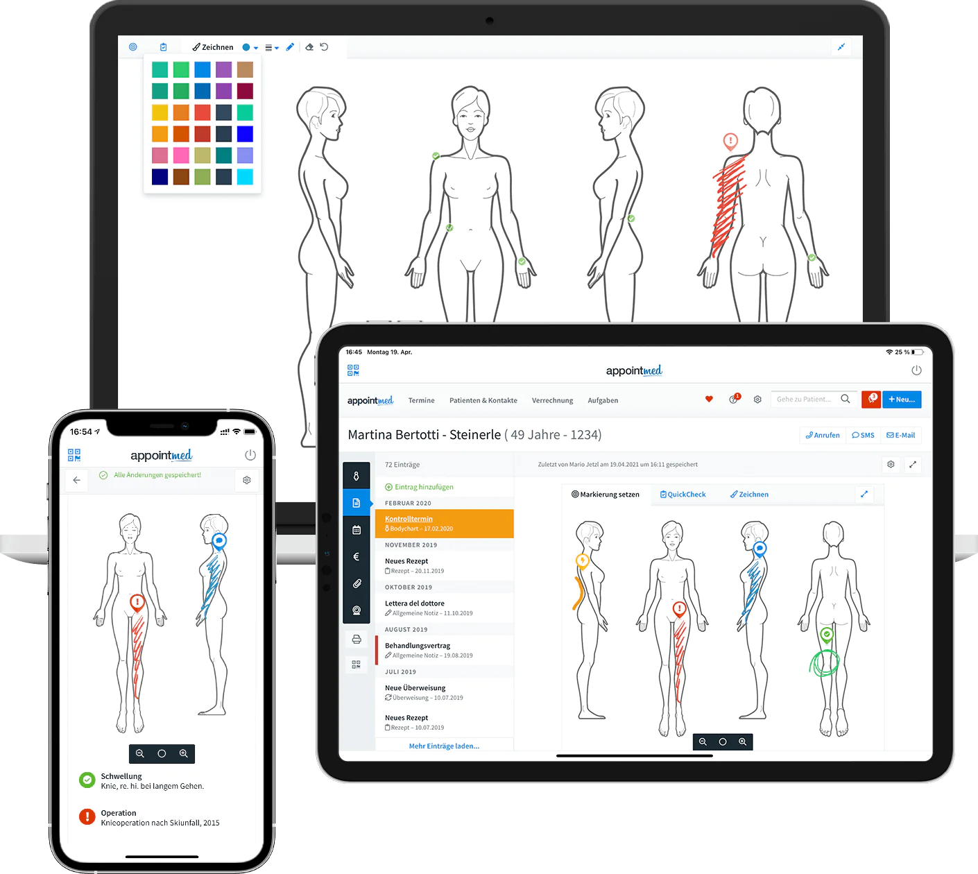 Grafische Dokumentation mit Bodycharts am Computer, Tablet und Smartphone